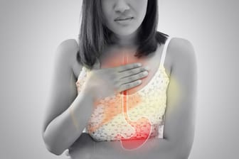 Je öfter die Magensäure in die Speiseröhre gelangt, desto höher ist das Risiko, dass die Schleimhäute langfristig geschädigt werden.