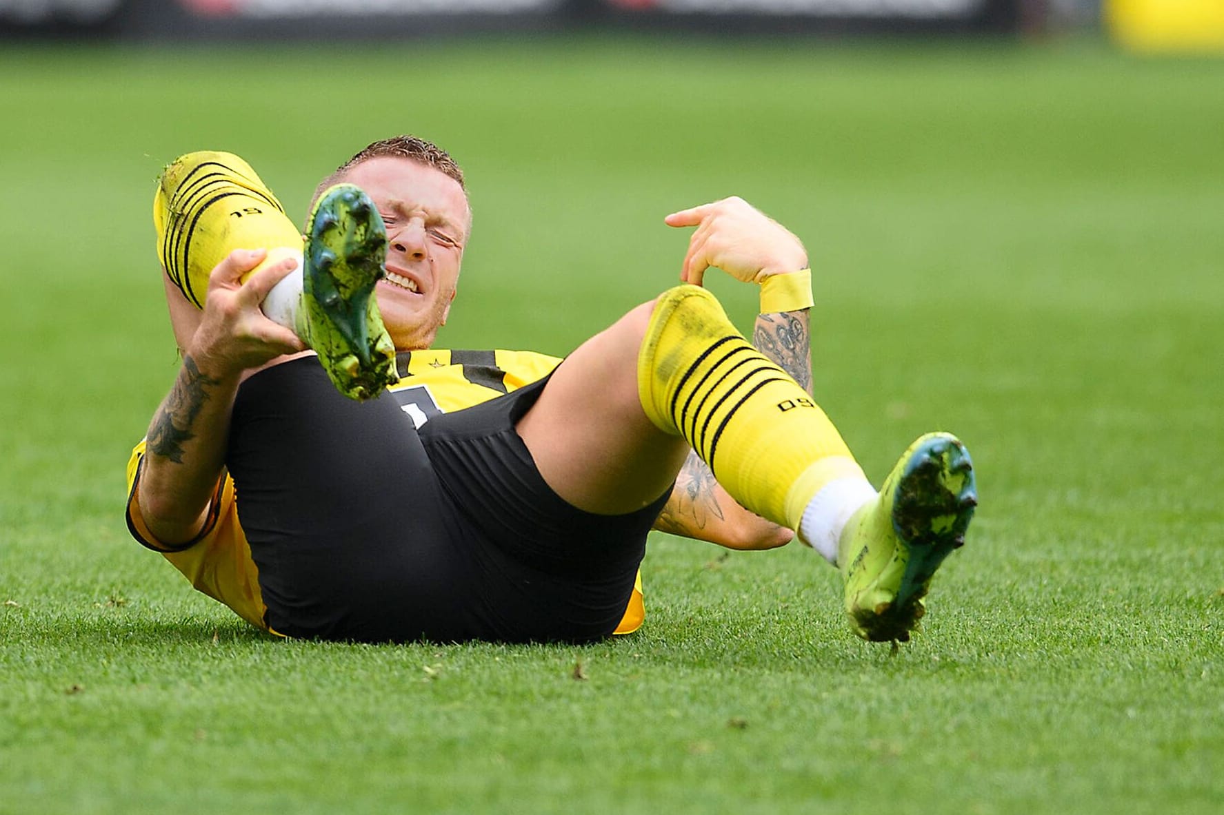 Marco Reus: Der Kapitän der Borussia fällt offenbar nicht so lange aus wie befürchtet.