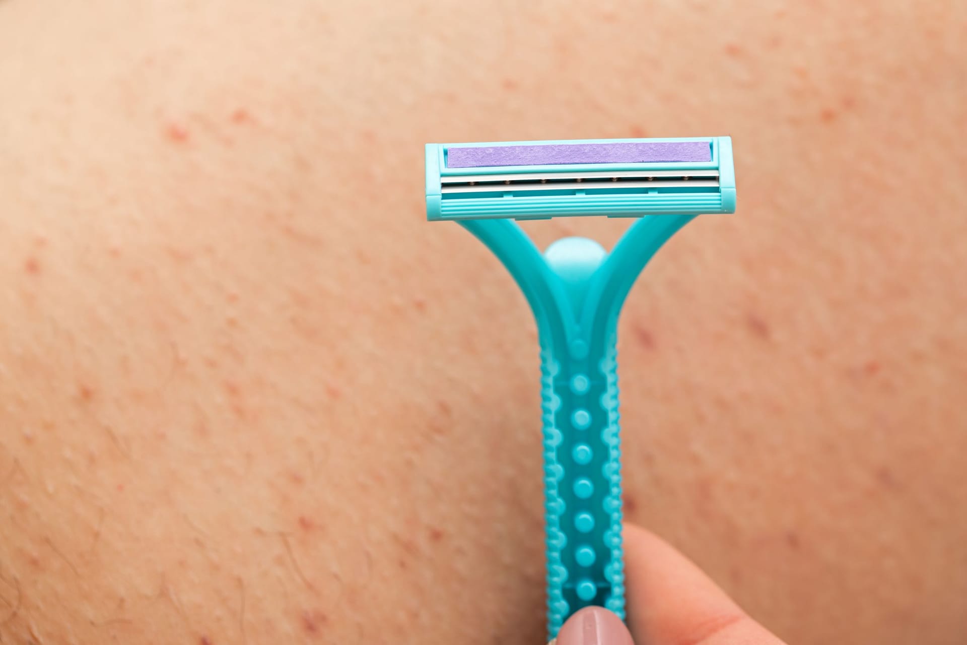 Rasierpickel: Durchs Rasieren können kleine, rote Pickel auf der Haut entstehen.