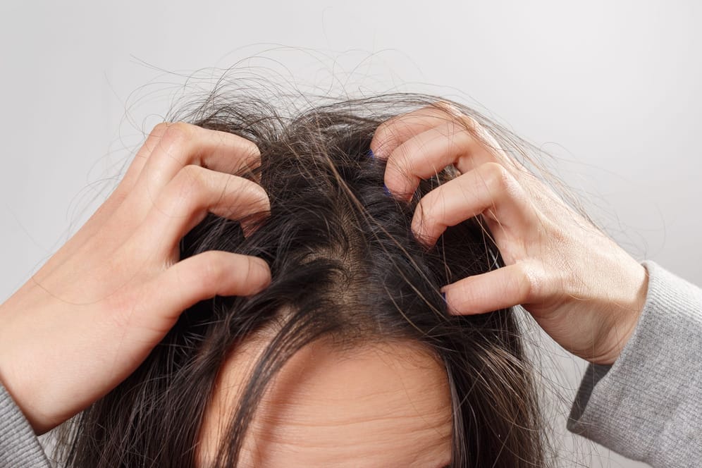 ﻿Kopfläuse können jeden befallen. Häufiges Haarewaschen verhindert keine Ansteckung.