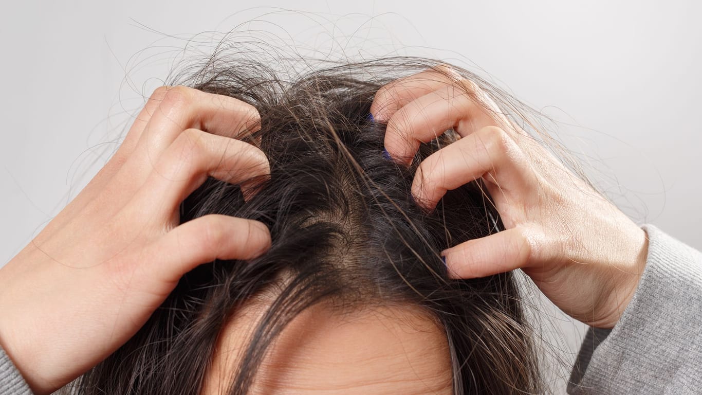 Kopfläuse können jeden befallen. Häufiges Haarewaschen verhindert keine Ansteckung.