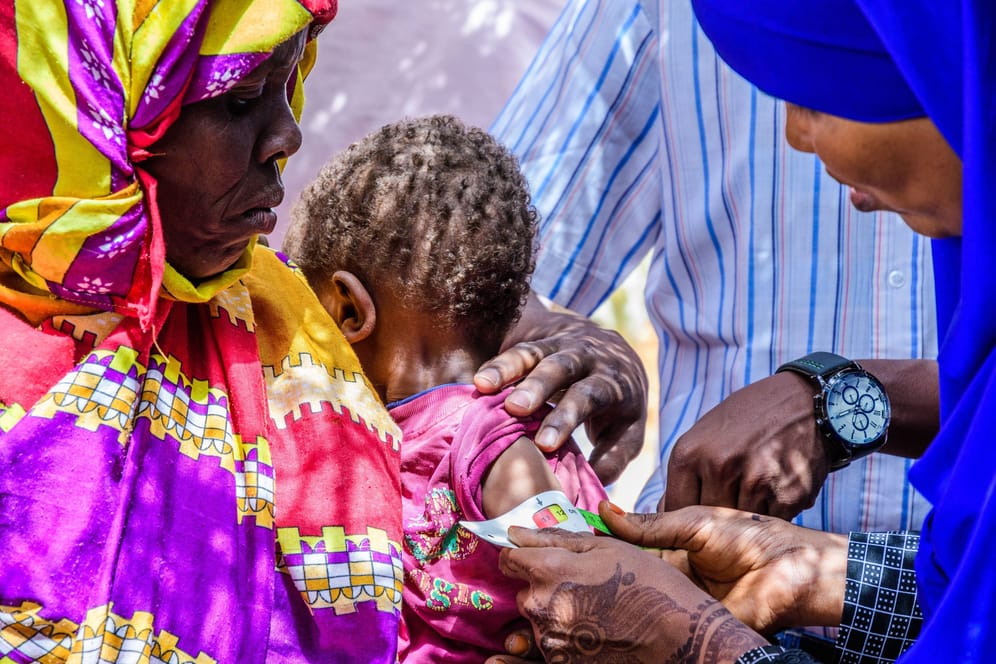 Mitarbeiter messen den Grad der Unterernährung bei einem Kind in Somalia: In Afrika und Südasien ist die Hungersituation besonders ernst.