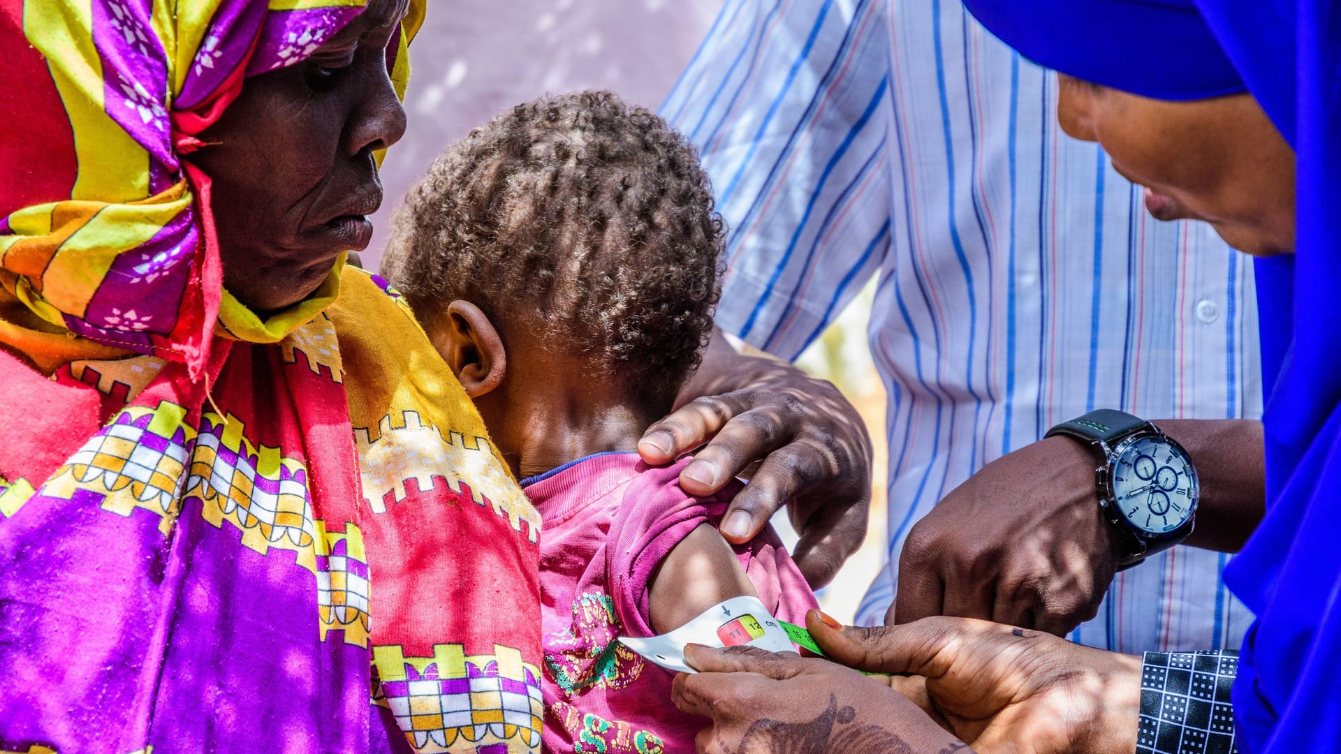 Mitarbeiter messen den Grad der Unterernährung bei einem Kind in Somalia: In Afrika und Südasien ist die Hungersituation besonders ernst.