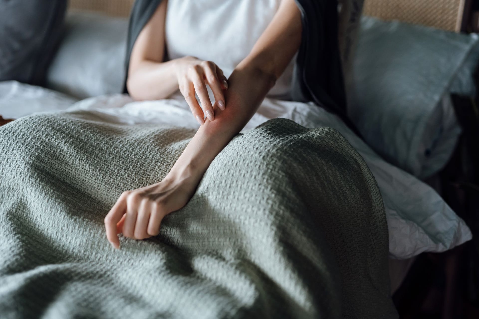 Psychischer Stress: Das Gefühl, alle Blicke auf sich zu ziehen sowie ständiges Jucken und Schmerzen der Haut kann zur großen Herausforderung werden.