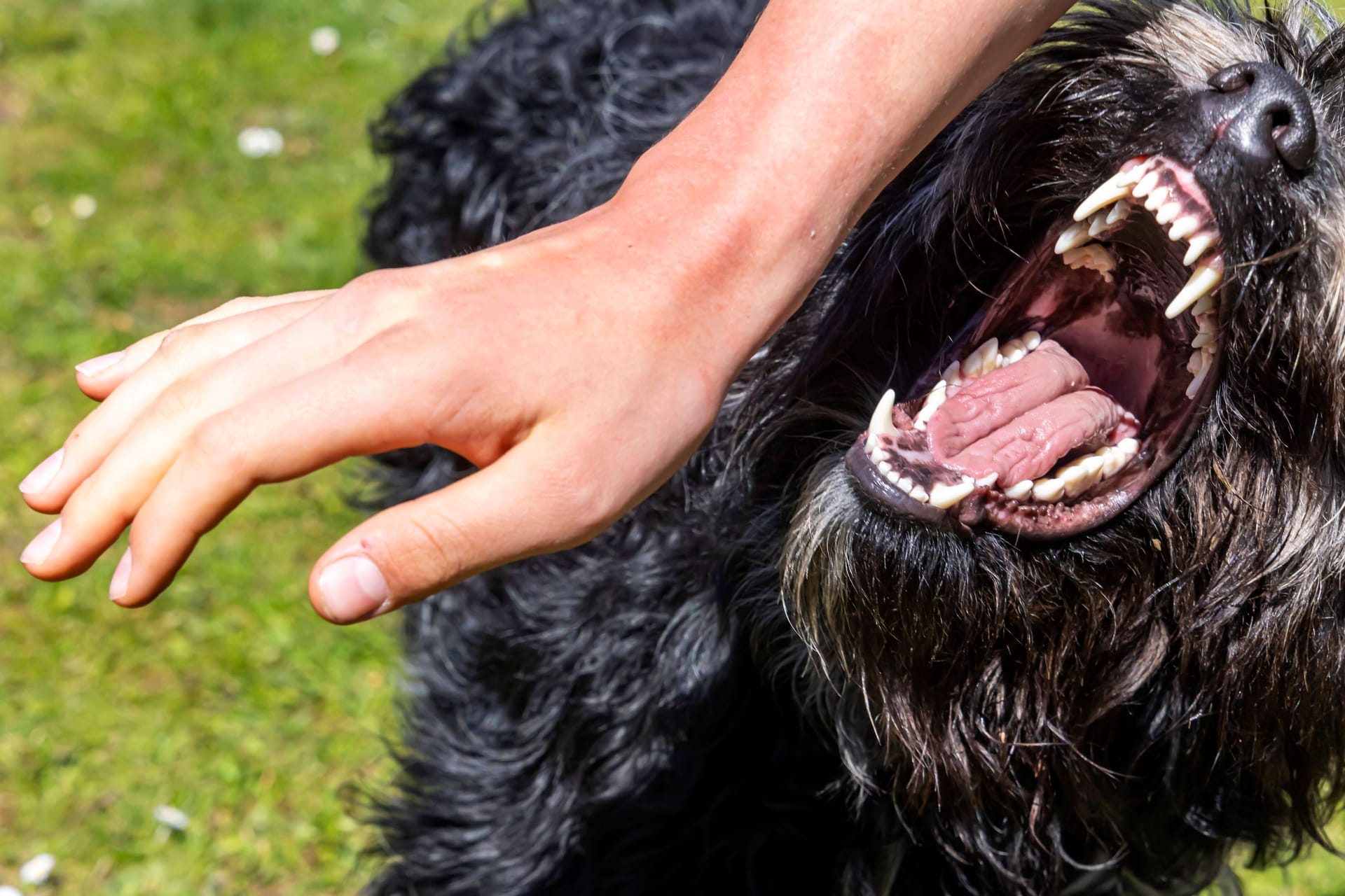 Bissattacke eines Hundes (Symbolfoto): Der Senior kam mit schweren Verletzungen ins Krankenhaus.