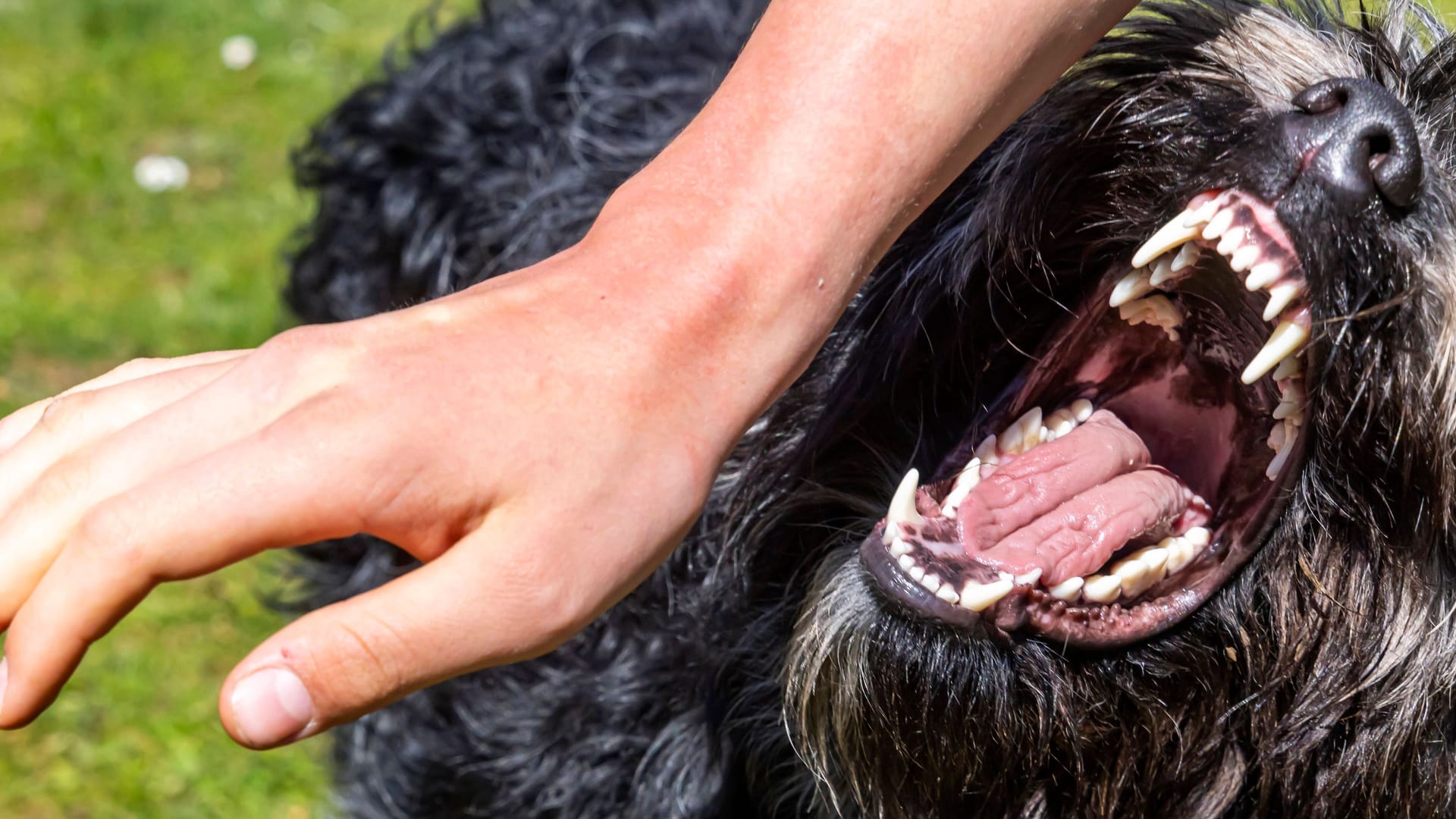 Bissattacke eines Hundes (Symbolfoto): Der Senior kam mit schweren Verletzungen ins Krankenhaus.