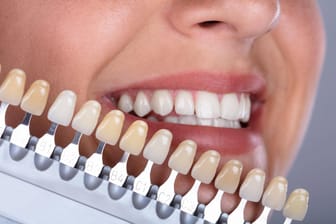 Natürlich bedingt: Die durchschimmernde Farbe des Zahnbeins ist oft schon genetisch veranlagt.