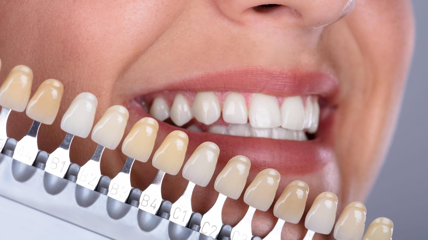 Natürlich bedingt: Die durchschimmernde Farbe des Zahnbeins ist oft schon genetisch veranlagt.