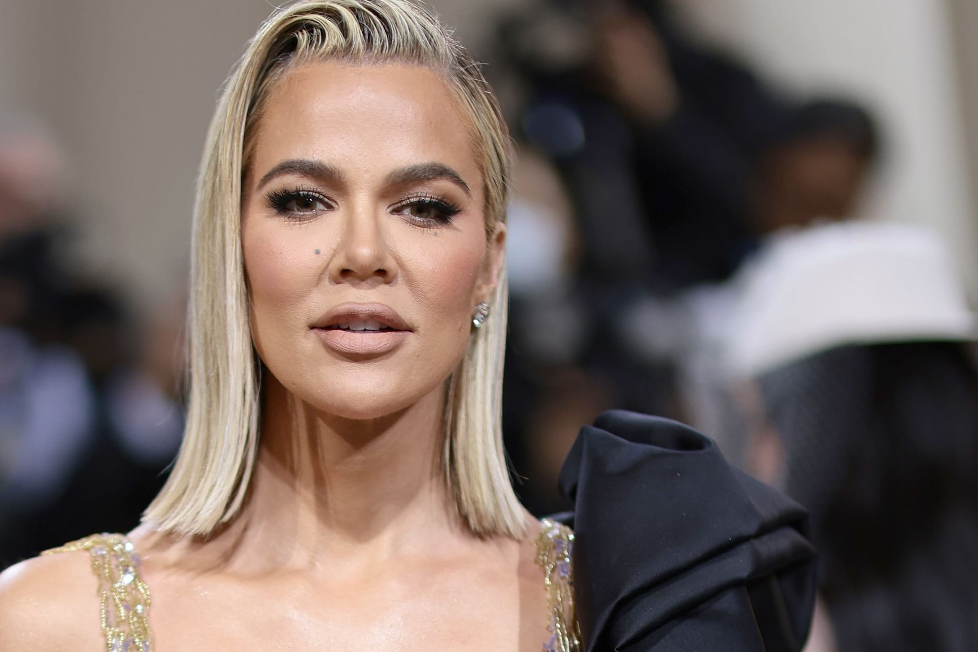 Khloé Kardashian: Sie hatte einen Tumor an der Wange.