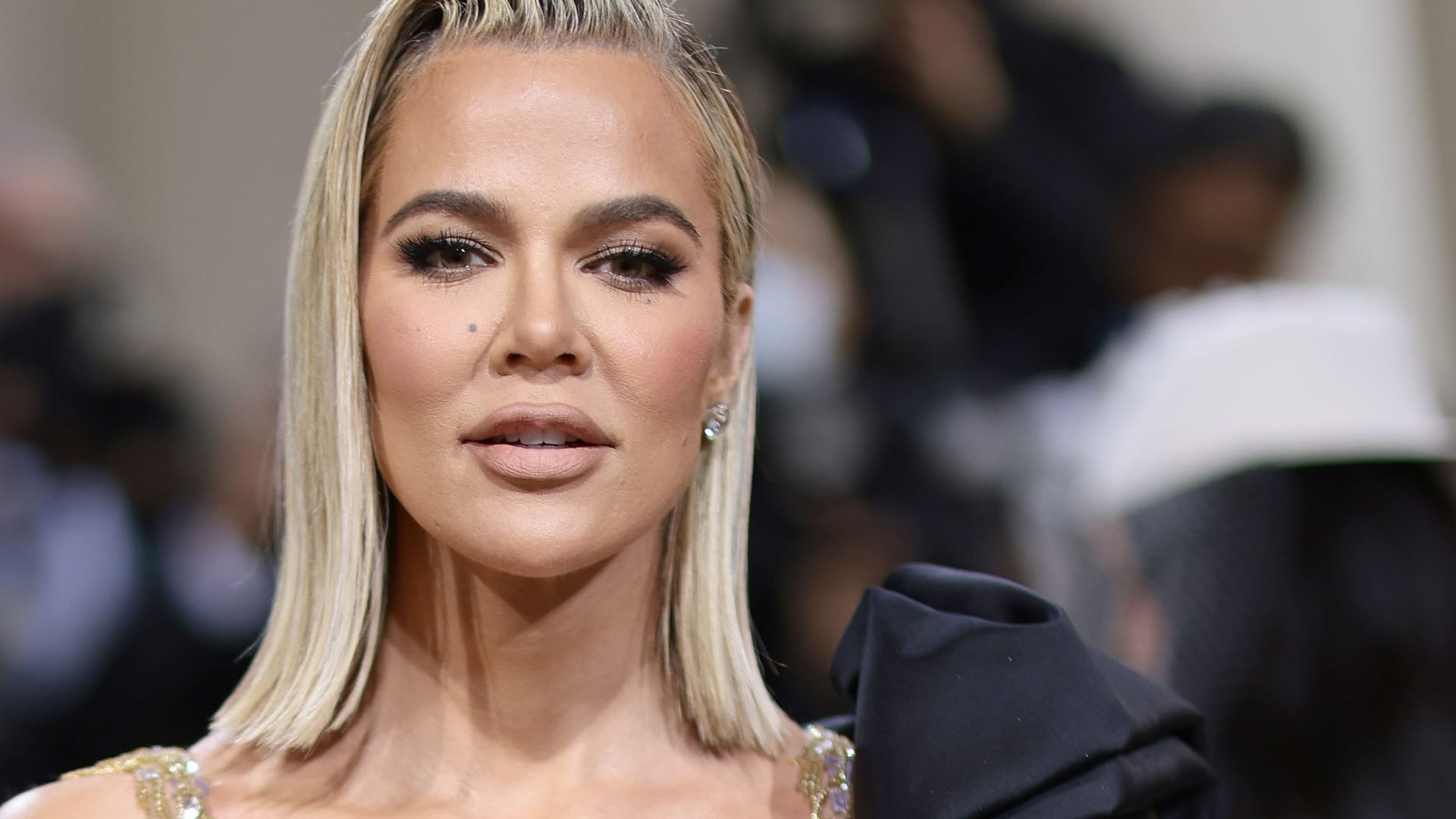 Khloé Kardashian: Sie hatte einen Tumor an der Wange.