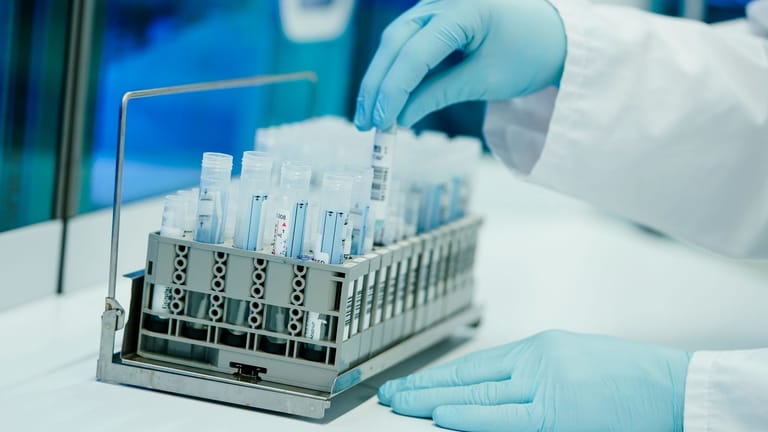 Ein Laborant arbeitet in einem Labor für Corona-Tests: Die Fallzahlen in Deutschland steigen wieder.