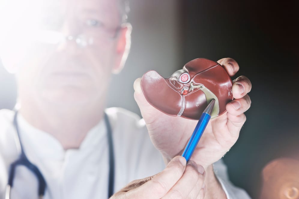 Arzt zeigt das Modell einer Gallenblase