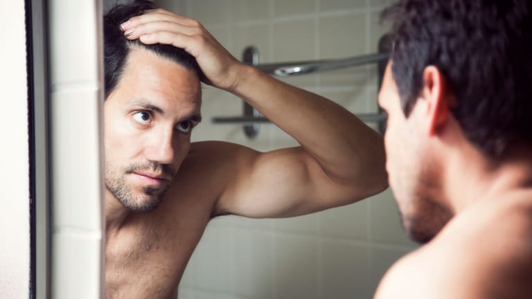 Haarausfall ist meist erblich bedingt. Bei Männern fängt es oft mit Geheimratsecken an.