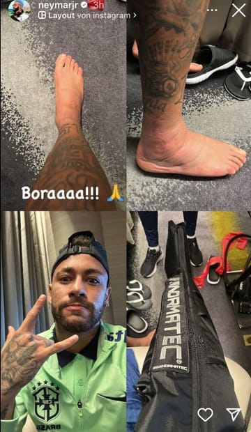 Neymars geschwollener Fuß: Neymar gibt sich trotzdem optimistisch.