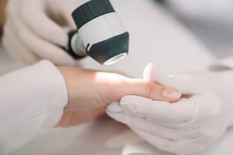 Hautärztliche Untersuchung einer Hand