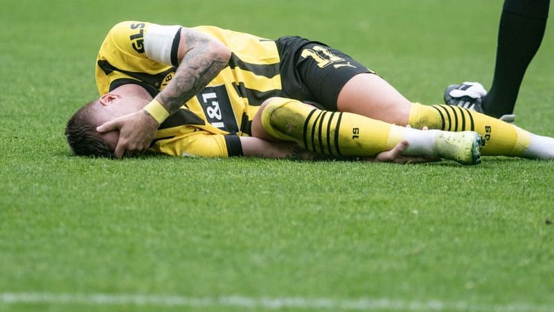 Marco Reus: Der Dortmund-Star hatte sich im Derby gegen Schalke verletzt. Marco Reus: Der Dortmund-Star hatte sich im Derby gegen Schalke verletzt.