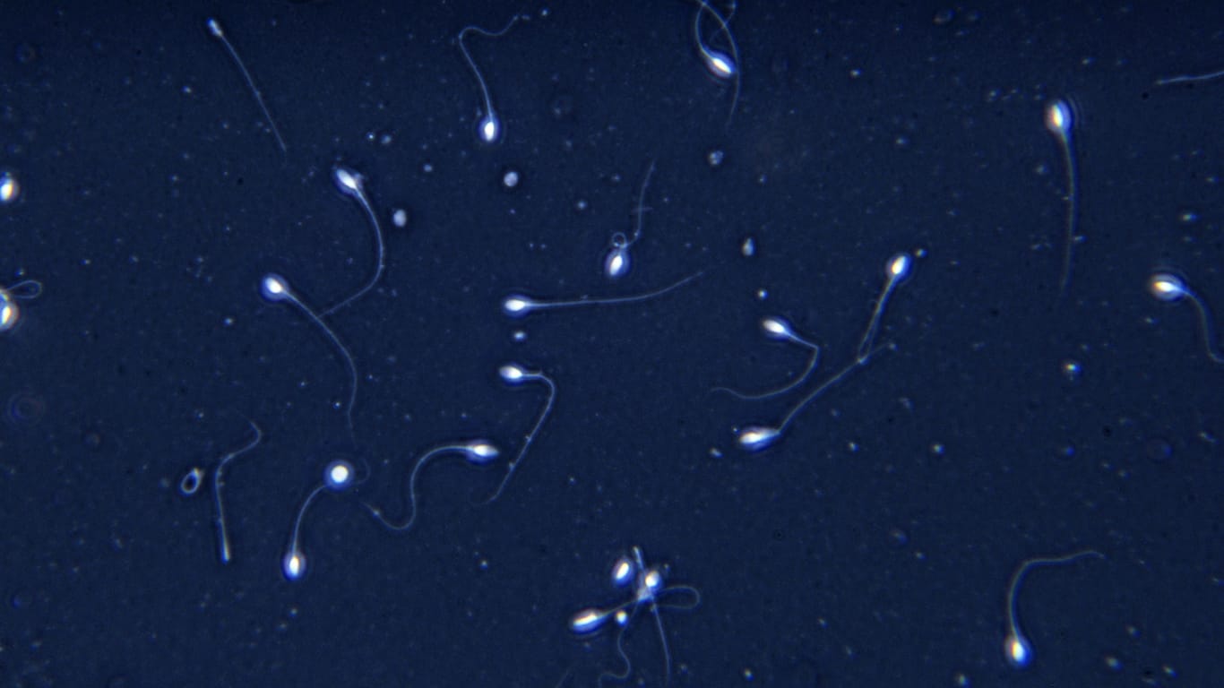 Menschliche Spermien: Zwischen 1973 und 2018 sank die durchschnittliche Spermienkonzentration um mehr als 51 Prozent.