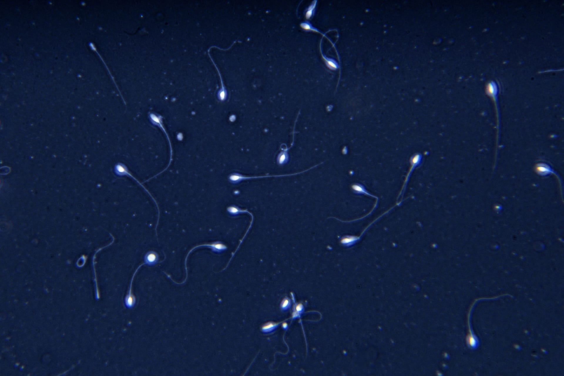 Menschliche Spermien: Zwischen 1973 und 2018 sank die durchschnittliche Spermienkonzentration um mehr als 51 Prozent.