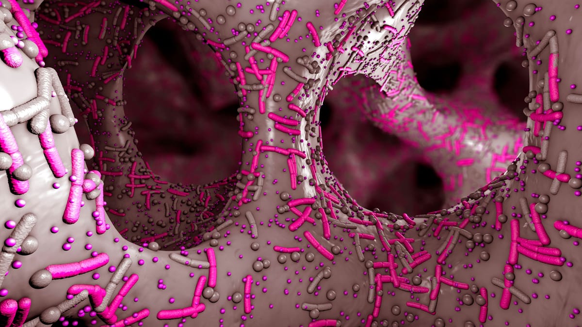 Darmflora aufbauen: So fördern Sie Schritt für Schritt Ihre Darmgesundheit