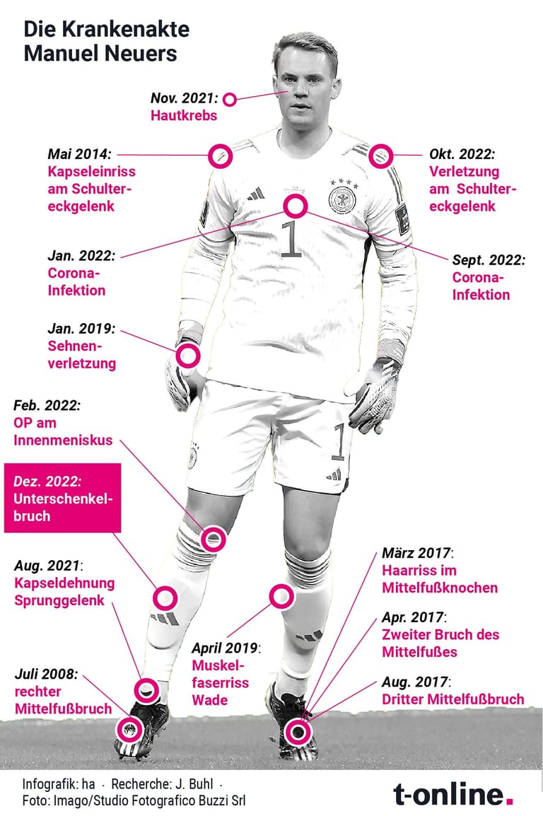 Manuel Neuer: Der Torhüter des FC Bayern hat bereits eine lange Krankenakte.