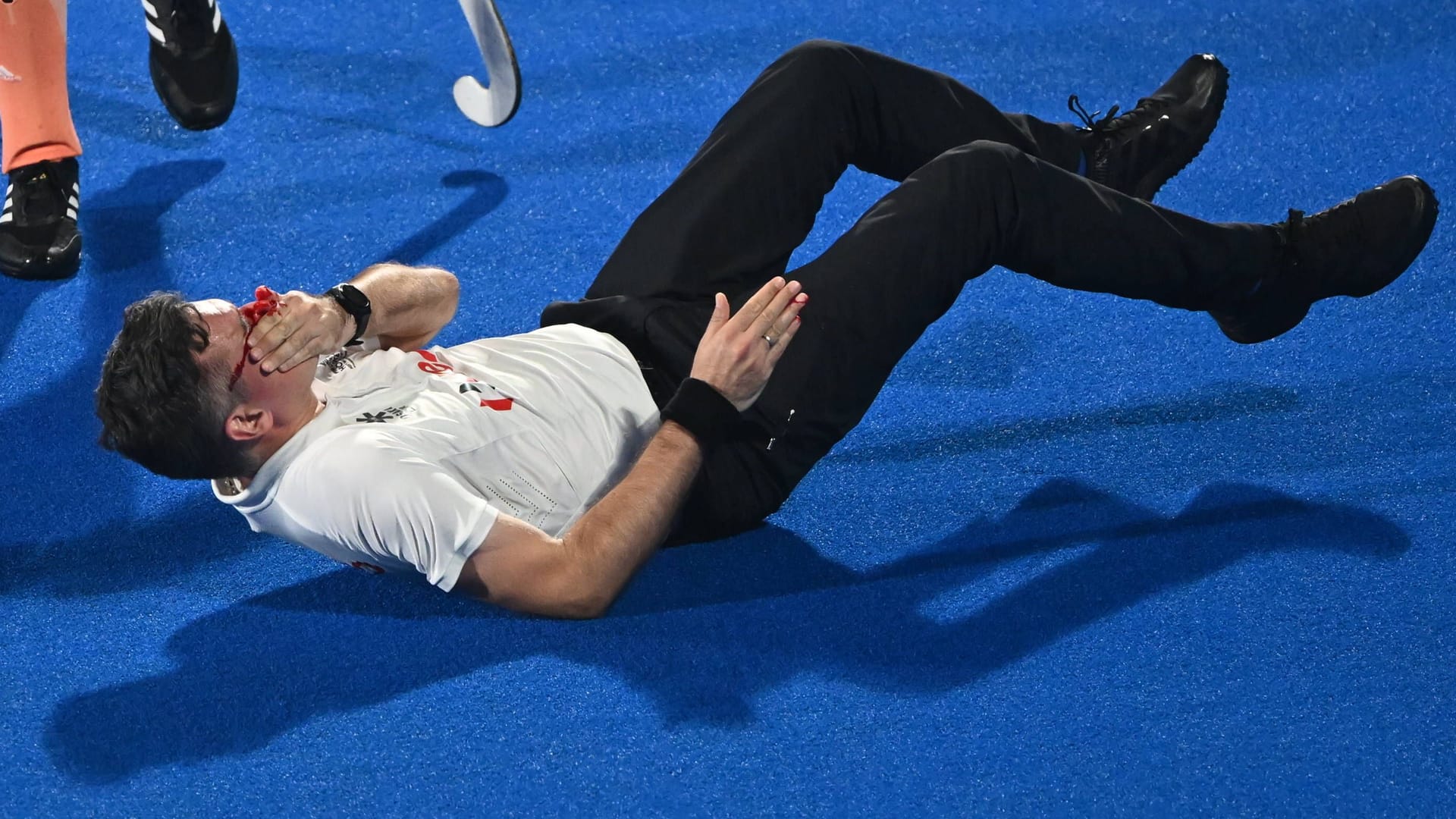 Schiedsrichter Ben Goentgen wurde von einem Ball böse im Gesicht getroffen.