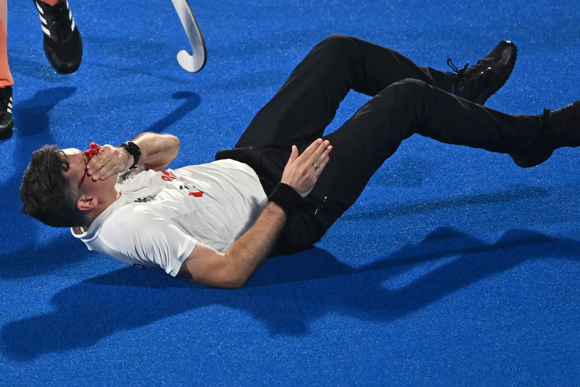 Schiedsrichter Ben Goentgen wurde von einem Ball böse im Gesicht getroffen.