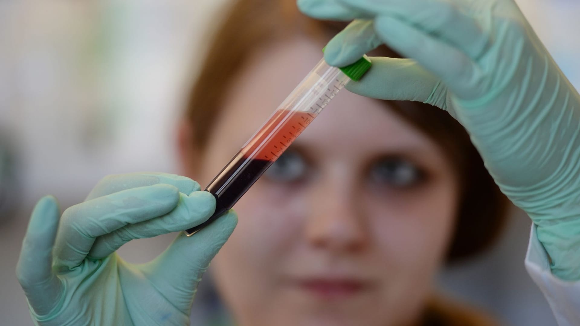 Bluttest auf Trisomien