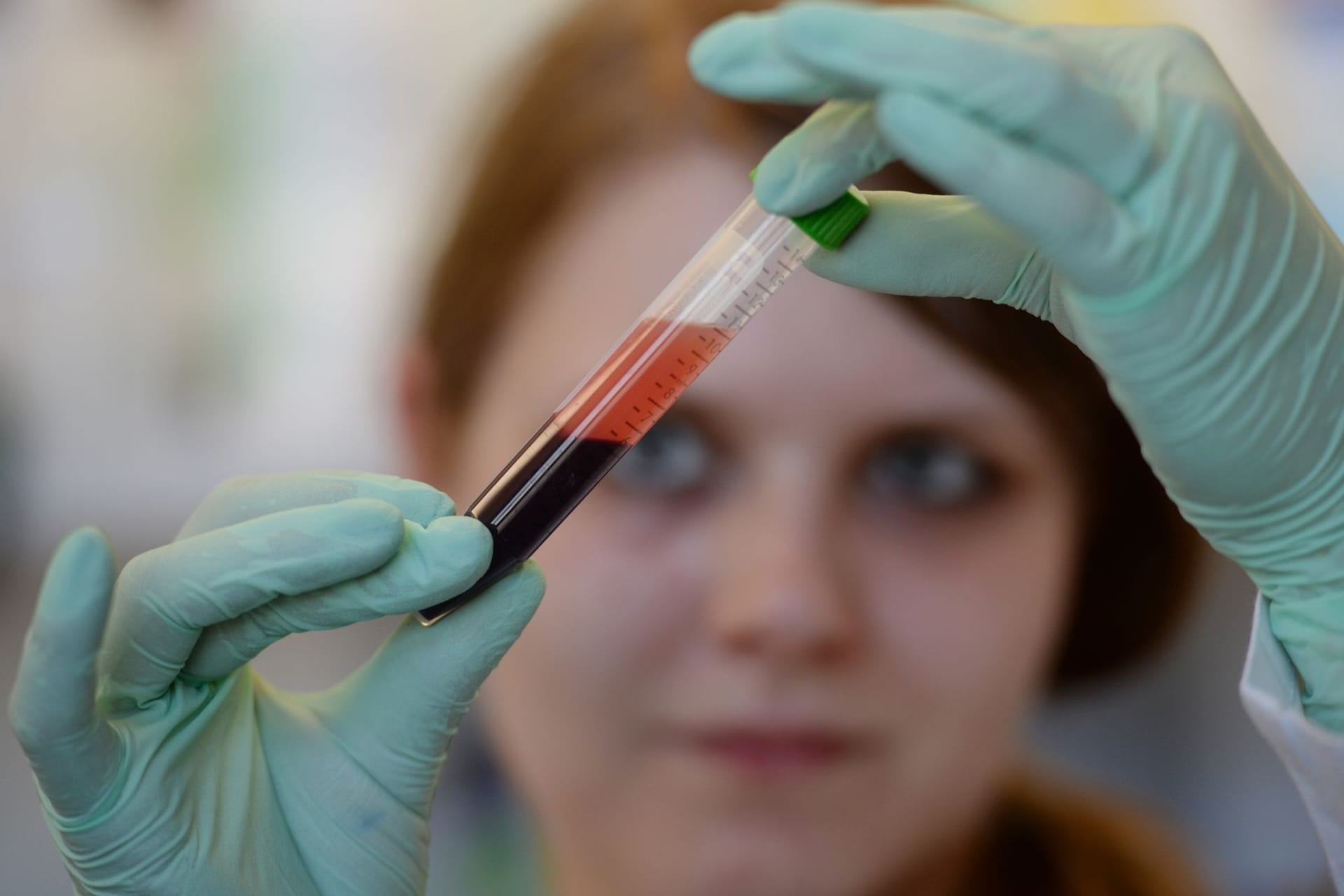 Bluttest auf Trisomien