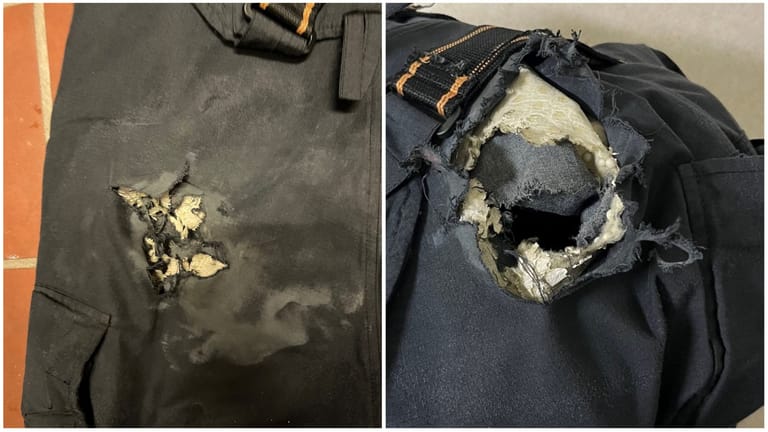 Weitere Fotos der zerstörten Kleidung: Das Opfer erlitt Verbrennungen am Oberschenkel.