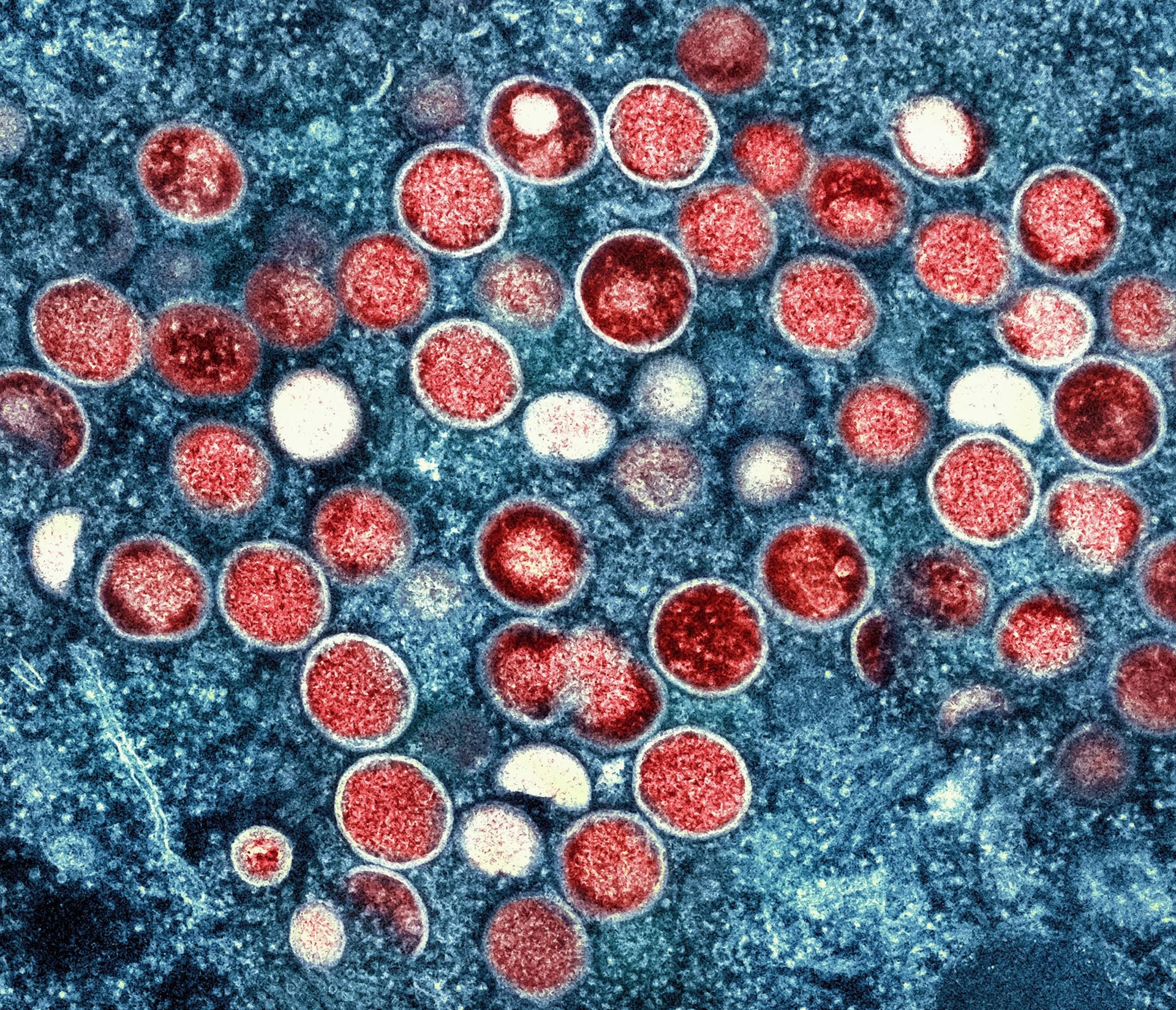 Affenpocken: Eine eingefärbte Mikroskopaufnahme von Affenpocken-Partikeln (rot) in einer infizierten Zelle (blau).