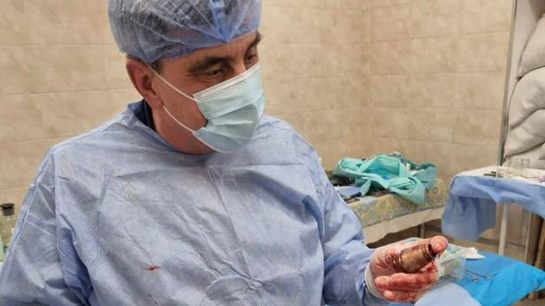Chirurg der Streitkräfte der Ukraine - Andriy Verba zeigt ein Teil der VOG-Granate, die einem ukrainischen Soldaten aus dem Körper entfernt wurde. Das Foto wurde von Hanna Maliar, der stellvertretenden Verteidigungsministerin der Ukraine veröffentlicht.