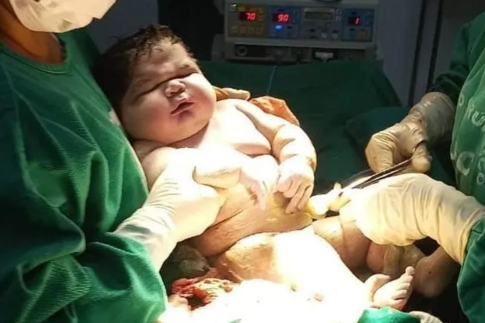 Der kleine Angerson nach seiner Geburt am 18. Dezember: "Ich dachte, es wären vier Kilo".