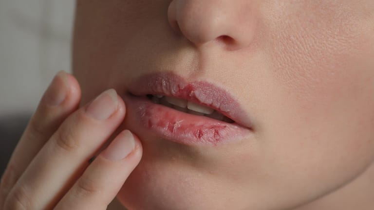﻿Im Winter werden Lippen mehr als sonst strapaziert.