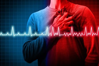Bei einem Vorhofflimmern breiten sich elektrische Impulse in den Vorhöfen des Herzens unregelmäßig aus. Die Herzkammern pumpen zwar weiter Blut in den Körper, allerdings weniger und unregelmäßiger.