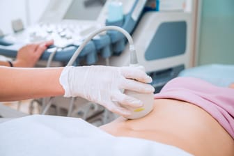 Eine Frau wird mit dem Ultraschall untersucht.