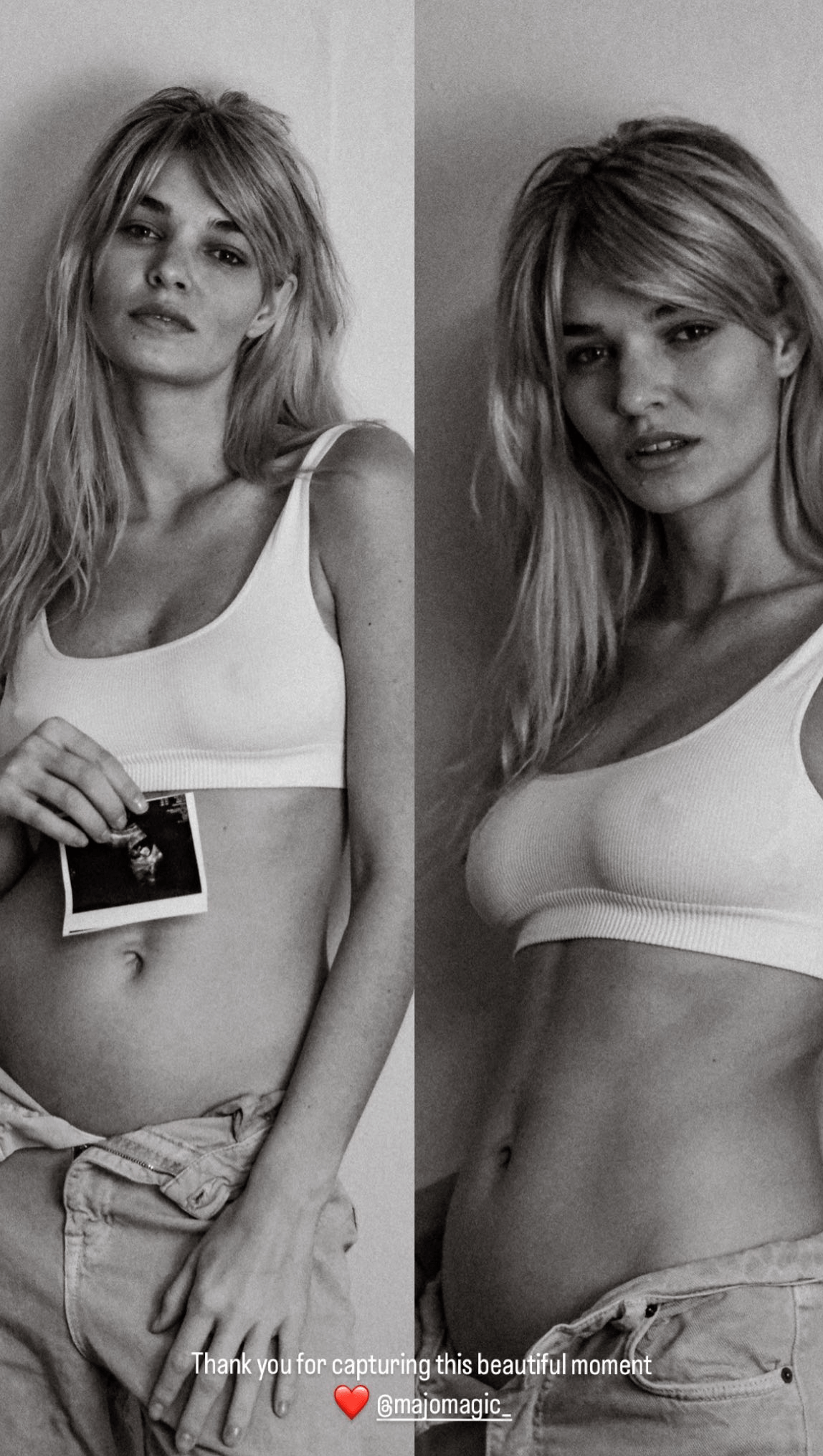 Mit diesen Fotos macht Luisa Hartema ihre Schwangerschaft publik.