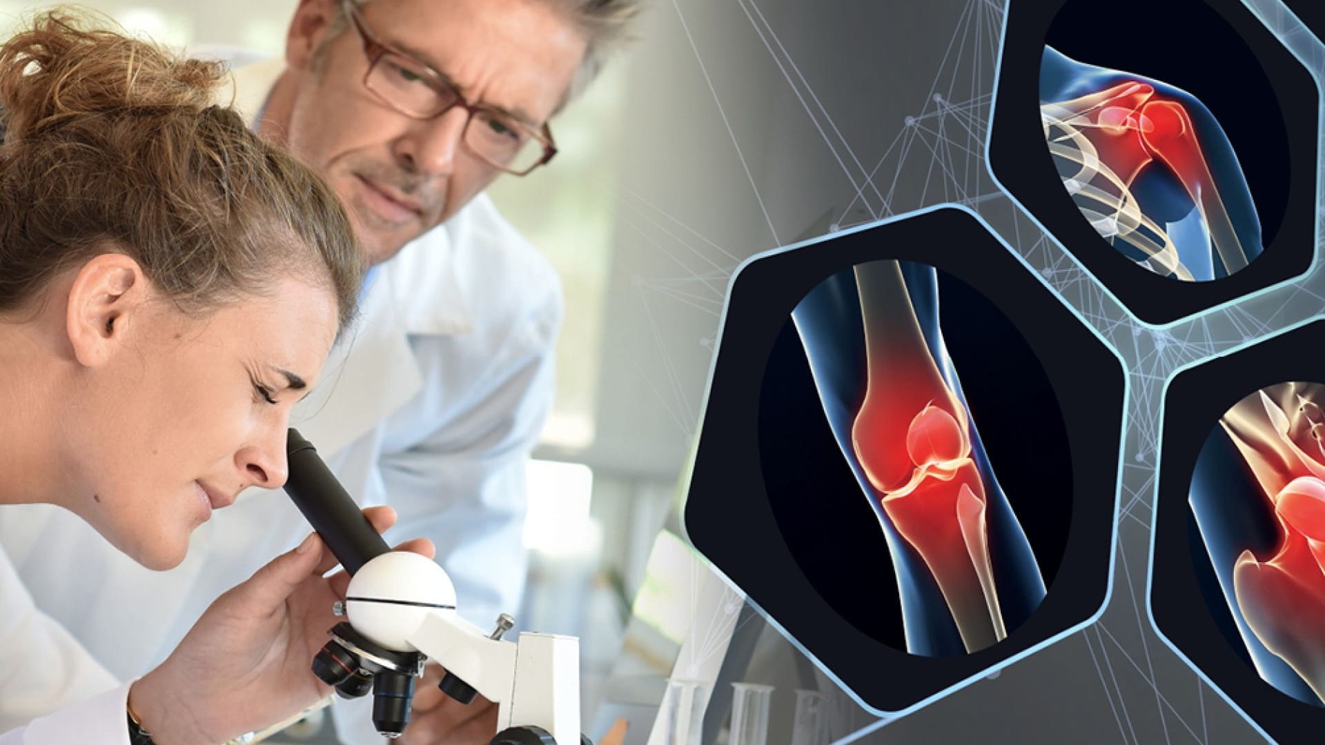 Faszinierender Wirkstoff: Von der Krebsforschung zur Hoffnung für Millionen Arthrose-Patienten. Faszinierender Wirkstoff: Von der Krebsforschung zur Hoffnung für Millionen Arthrose-Patienten.
