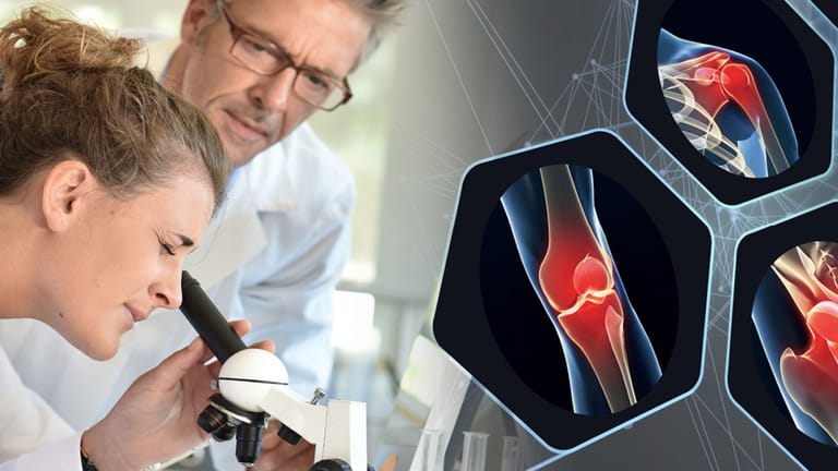 Faszinierender Wirkstoff: Von der Krebsforschung zur Hoffnung für Millionen Arthrose-Patienten.