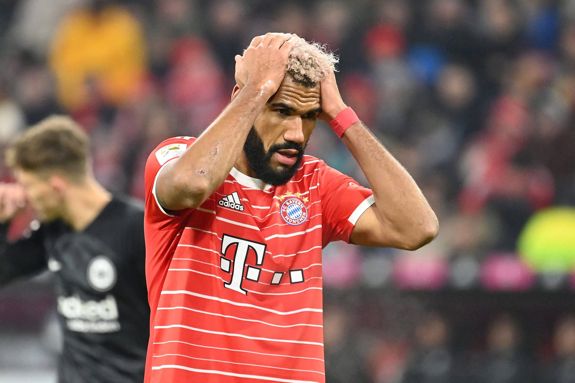 Eric Maxim Choupo-Moting: Der Bayern-Stürmer musste das Training abbrechen. Fällt er gegen Leverkusen aus?