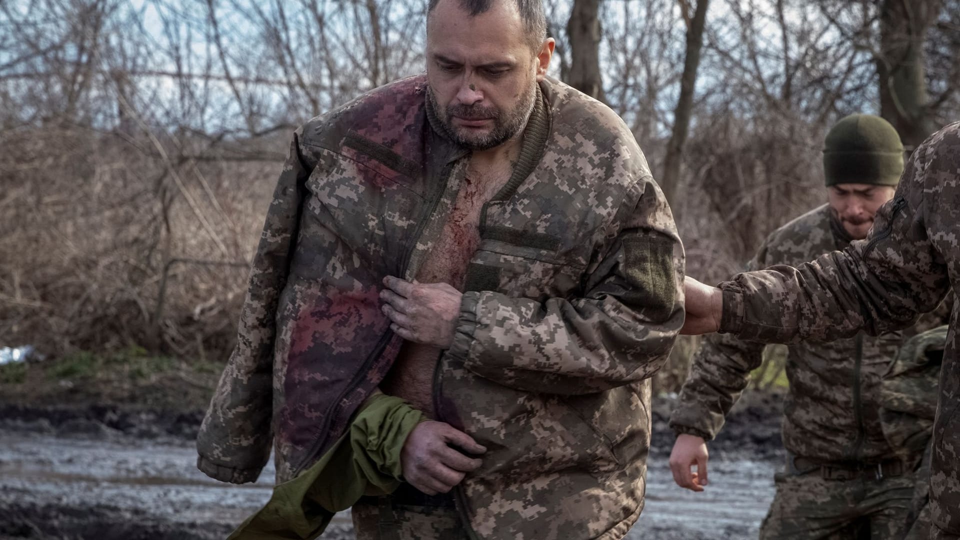 Verletzter ukrainischer Soldat in Bachmut: Die ukrainischen Truppen klagen weiter über Munitionsmangel.