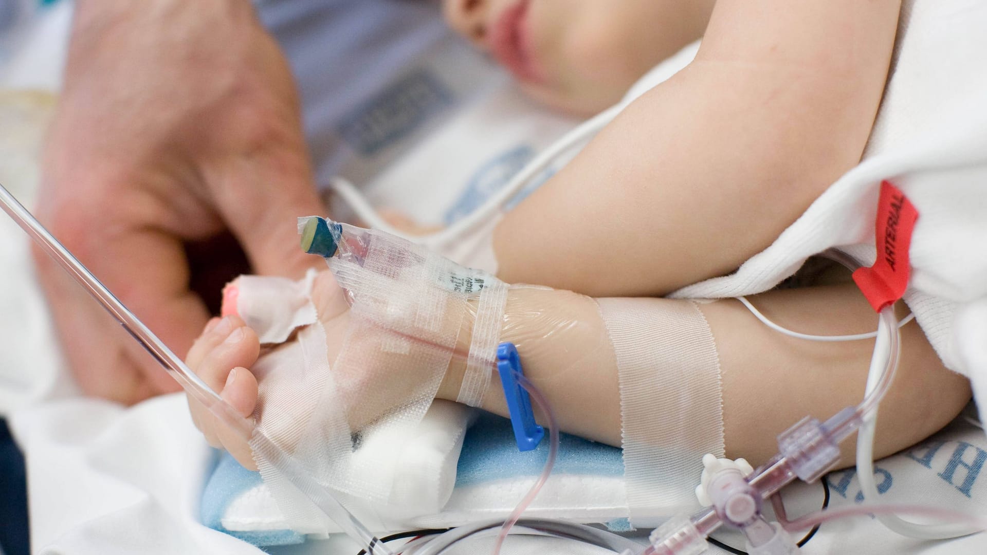 Ein Kleinkind liegt in einem Klinikbett (Symbolfoto): Die DAK untersuchte für ihre Berechnung die Abrechnungsscheine von 4.500 Kindern.