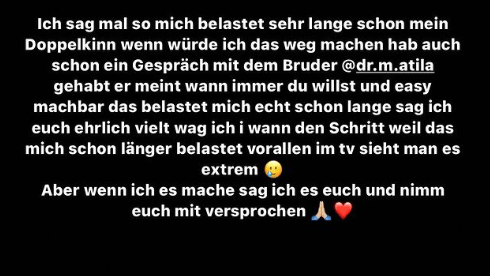 Pietro über sein Doppelkinn: Auf Instagram gab sich der Sänger sehr offen.