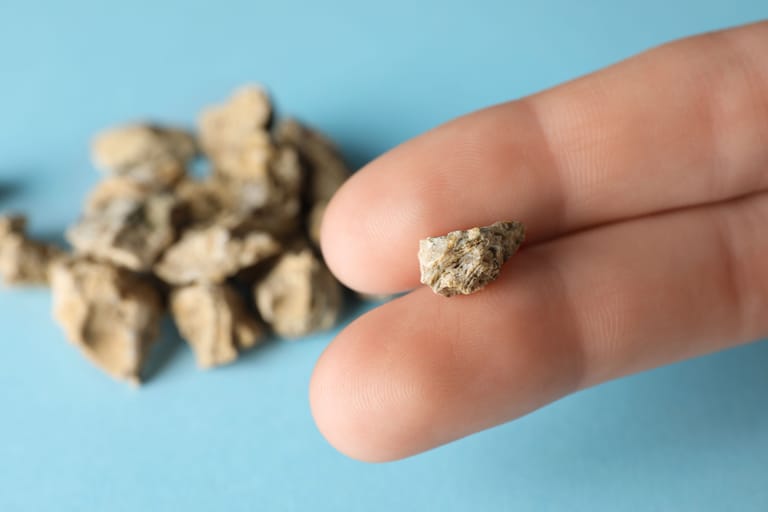 Nierensteine Ratgeber und Tipps zum Thema