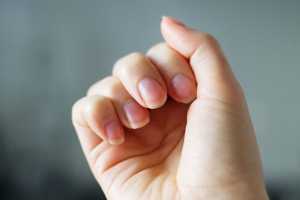 Wenn die Fingernägel splittern oder leicht abbrechen, kann das viele Ursachen haben. Nicht alle sind harmlos.