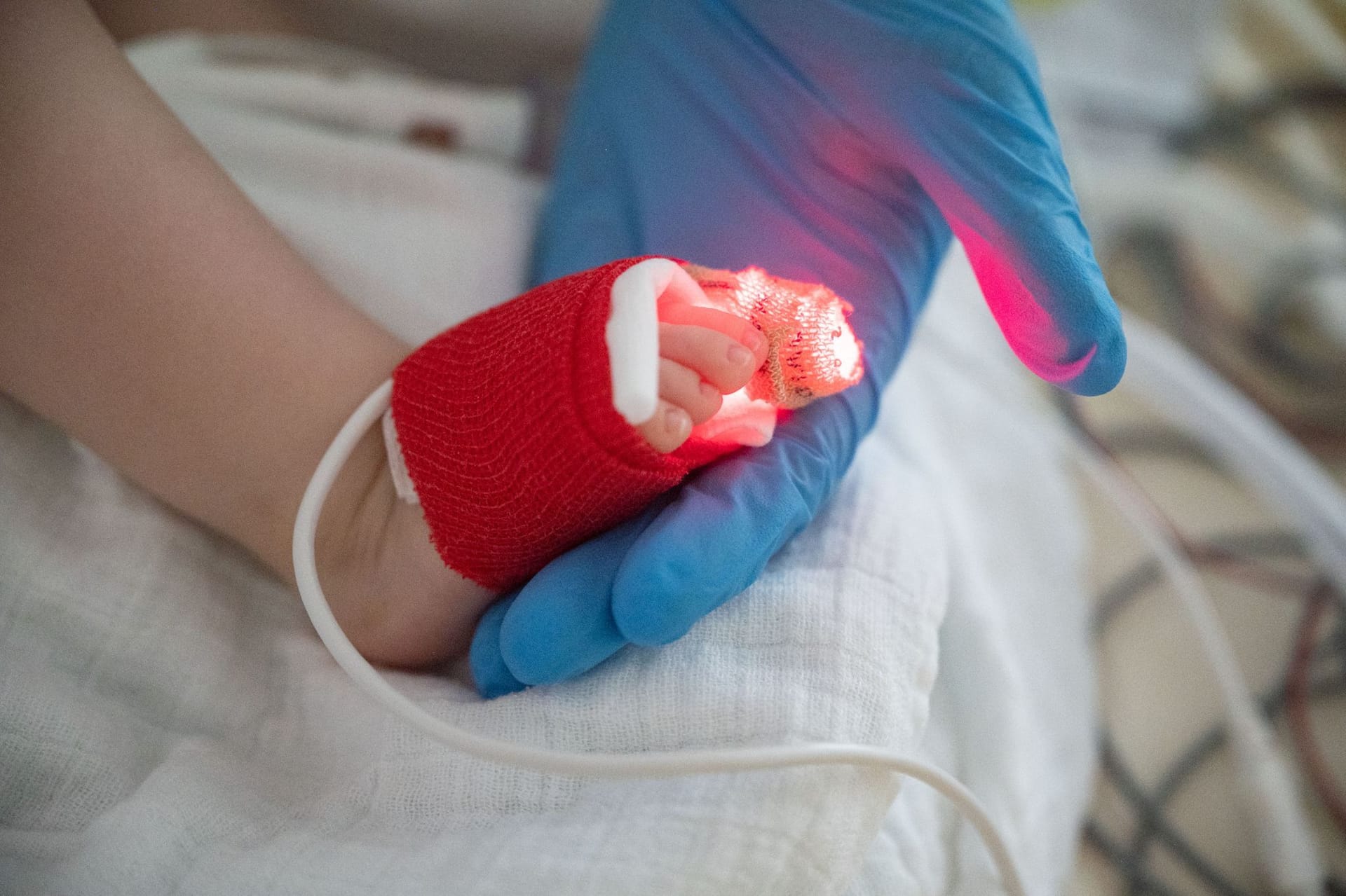 Eine Intensivpflegerin hält den Fuß eines am Respiratorischen Synzytial-Virus (RS-Virus oder RSV) erkrankten Kindes (Archivbild): In Hamburg sind immer mehr Babys betroffen.