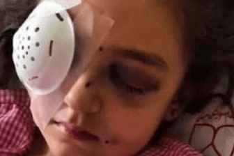 Benita Kiani Flavarjani: Die Fünfjährige ist auf einem Auge blind.