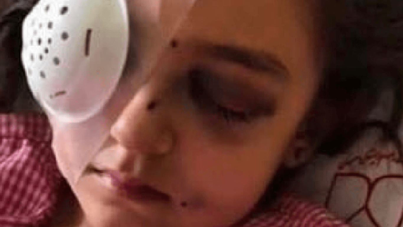 Benita Kiani Flavarjani: Die Fünfjährige ist auf einem Auge blind.