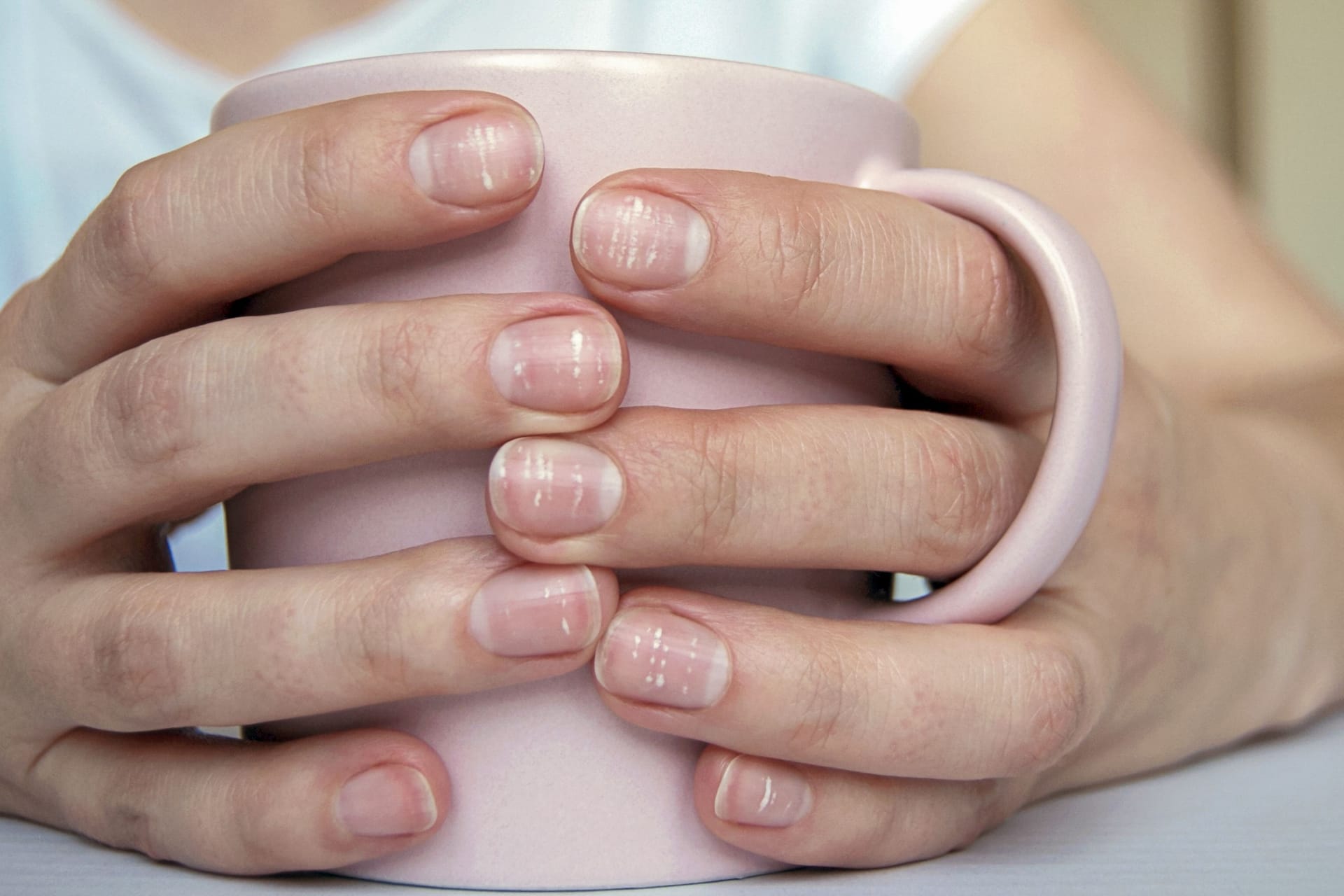 Weiße Flecken auf dem Fingernagel sind meist die Folge eines Lufteinschlusses, der durch kleine Verletzungen des Nagels entsteht.