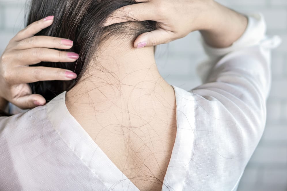 Eine Frau mit ausgefallenen Haaren am Rücken.