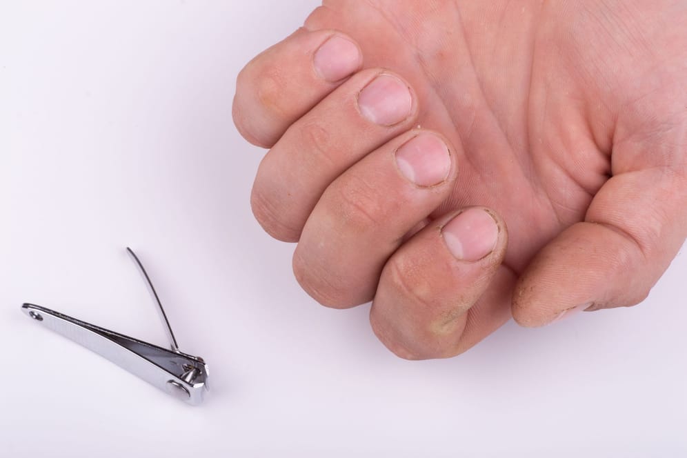 Bei zu kurzen Fingernägeln können chemische Substanzen unter den Nagel eindringen.